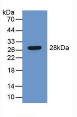 Invitrogen SERPINB1 Polyclonal Antibody:Antibodies:Primary Antibodies