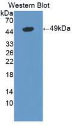 Invitrogen LSR Polyclonal Antibody 20 μL; Unconjugated:Antibodies, Polyclonal