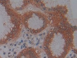 Invitrogen JMJD2A Polyclonal Antibody 20 &mu;L; Unconjugated:Antibodies,