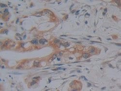 Invitrogen JMJD2A Polyclonal Antibody 20 &mu;L; Unconjugated:Antibodies,