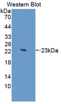 Invitrogen JMJD2A Polyclonal Antibody 20 &mu;L; Unconjugated:Antibodies,