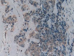 Invitrogen LPCAT3 Polyclonal Antibody:Antibodies:Primary Antibodies