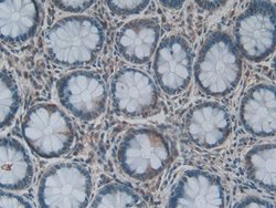 Invitrogen LPCAT3 Polyclonal Antibody:Antibodies:Primary Antibodies