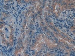 Invitrogen LPCAT3 Polyclonal Antibody:Antibodies:Primary Antibodies
