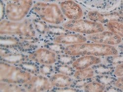 Invitrogen LPCAT3 Polyclonal Antibody:Antibodies:Primary Antibodies