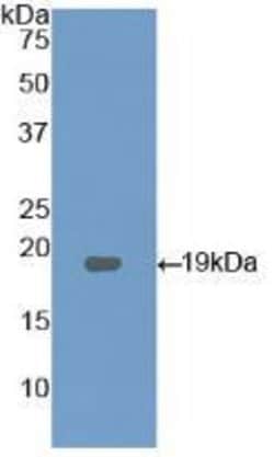 Invitrogen LPCAT3 Polyclonal Antibody:Antibodies:Primary Antibodies