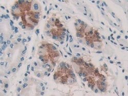 Invitrogen KARS Polyclonal Antibody 200 &mu;L; Unconjugated:Antibodies,