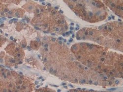 Invitrogen KARS Polyclonal Antibody 200 &mu;L; Unconjugated:Antibodies,