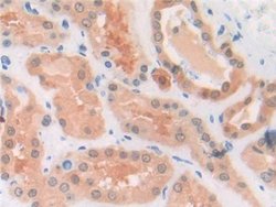 Invitrogen MIF Polyclonal Antibody 200 &mu;L | Buy Online | Invitrogen&trade; | Fisher Scientific