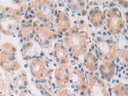 Invitrogen MIF Polyclonal Antibody 200 &mu;L | Buy Online | Invitrogen&trade; | Fisher Scientific
