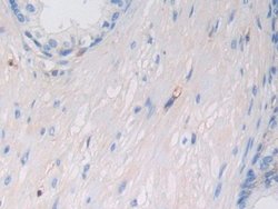 Invitrogen HLA-C Polyclonal Antibody:Antibodies:Primary Antibodies