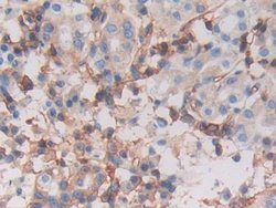 Invitrogen HLA-C Polyclonal Antibody:Antibodies:Primary Antibodies