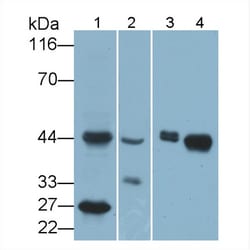 Invitrogen HLA-C Polyclonal Antibody:Antibodies:Primary Antibodies