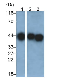 Invitrogen HLA-C Polyclonal Antibody:Antibodies:Primary Antibodies
