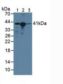 Invitrogen HLA-C Polyclonal Antibody:Antibodies:Primary Antibodies