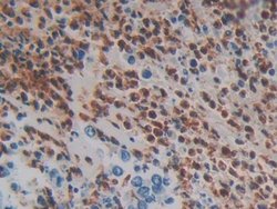 Invitrogen MASP1 Polyclonal Antibody:Antibodies:Primary Antibodies
