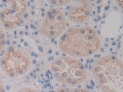 Invitrogen MASP1 Polyclonal Antibody:Antibodies:Primary Antibodies