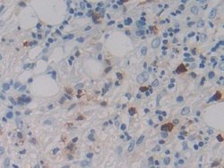 Invitrogen MASP1 Polyclonal Antibody:Antibodies:Primary Antibodies