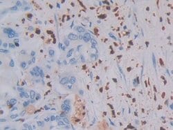 Invitrogen MASP1 Polyclonal Antibody:Antibodies:Primary Antibodies