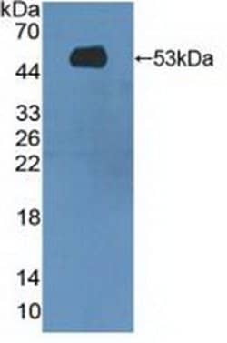 Invitrogen MASP1 Polyclonal Antibody:Antibodies:Primary Antibodies