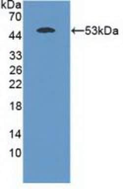 Invitrogen MASP1 Polyclonal Antibody 20 &mu;L; Unconjugated:Antibodies,