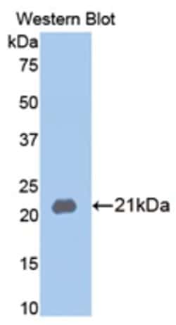 Invitrogen MMP13 Polyclonal Antibody 200 &mu;L; Unconjugated:Antibodies,