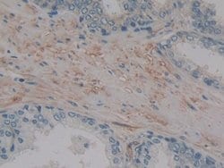 Invitrogen MMP14 Polyclonal Antibody:Antibodies:Primary Antibodies