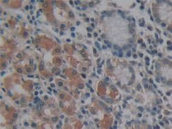 Invitrogen MMP14 Polyclonal Antibody:Antibodies:Primary Antibodies