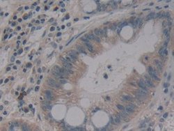 Invitrogen MMP14 Polyclonal Antibody:Antibodies:Primary Antibodies