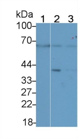 Invitrogen MMP14 Polyclonal Antibody:Antibodies:Primary Antibodies