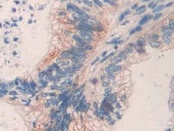 Invitrogen MMP24 Polyclonal Antibody 200 &mu;L; Unconjugated:Antibodies,