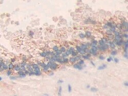 Invitrogen MMP24 Polyclonal Antibody 200 &mu;L; Unconjugated:Antibodies,