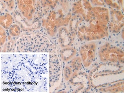 Invitrogen MMP24 Polyclonal Antibody 200 &mu;L; Unconjugated:Antibodies,