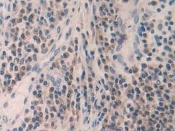 Invitrogen MMP24 Polyclonal Antibody 200 &mu;L; Unconjugated:Antibodies,