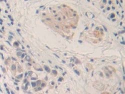 Invitrogen MMP24 Polyclonal Antibody 200 &mu;L; Unconjugated:Antibodies,