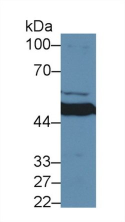 Invitrogen MMP24 Polyclonal Antibody 200 &mu;L; Unconjugated:Antibodies,