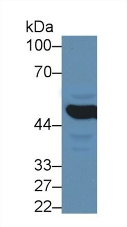 Invitrogen MMP24 Polyclonal Antibody 200 &mu;L; Unconjugated:Antibodies,
