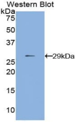 Invitrogen MMP24 Polyclonal Antibody 200 &mu;L; Unconjugated:Antibodies,
