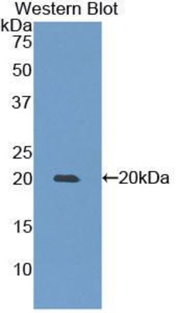 Invitrogen MMP9 Polyclonal Antibody 20 &mu;L; Unconjugated:Antibodies,