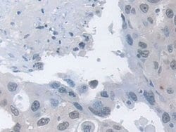 Invitrogen MPP5 Polyclonal Antibody 200 &mu;L; Unconjugated:Antibodies,