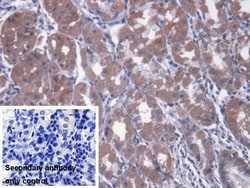 Invitrogen MTX1 Polyclonal Antibody:Antibodies:Primary Antibodies