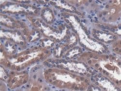 Invitrogen MTX1 Polyclonal Antibody:Antibodies:Primary Antibodies