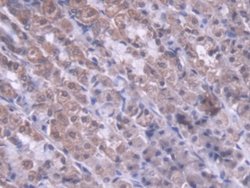 Invitrogen MTX1 Polyclonal Antibody:Antibodies:Primary Antibodies