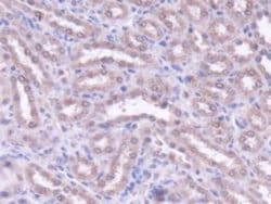 Invitrogen MTX1 Polyclonal Antibody:Antibodies:Primary Antibodies
