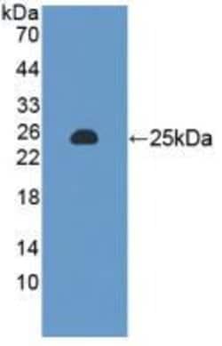 Invitrogen MTX1 Polyclonal Antibody:Antibodies:Primary Antibodies