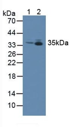 Invitrogen MTX1 Polyclonal Antibody 200 &mu;L; Unconjugated:Antibodies,