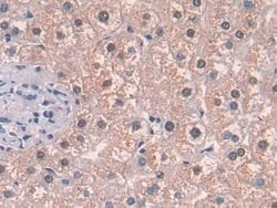 Invitrogen MAT2A Polyclonal Antibody:Antibodies:Primary Antibodies