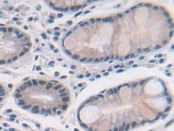 Invitrogen MAT2A Polyclonal Antibody:Antibodies:Primary Antibodies