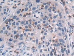 Invitrogen MAT2A Polyclonal Antibody:Antibodies:Primary Antibodies