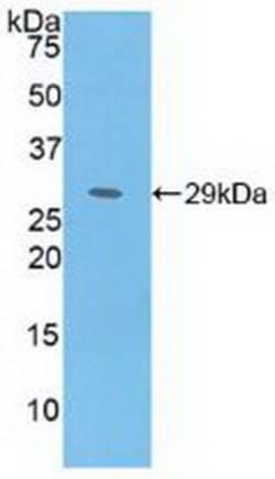 Invitrogen MAT2A Polyclonal Antibody:Antibodies:Primary Antibodies